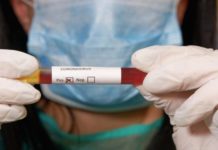 Tetë raste të reja me koronavirus në Kosovë — shërohen edhe 31 pacientë