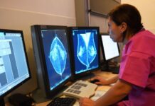 Gati 1 milion gra në Britani e humbën mamografinë, për shkak të pandemisë