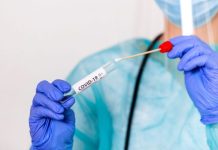 1.913 raste aktive me virus në vend