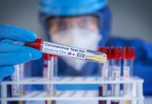 7 viktima dhe 378 raste të reja me virus