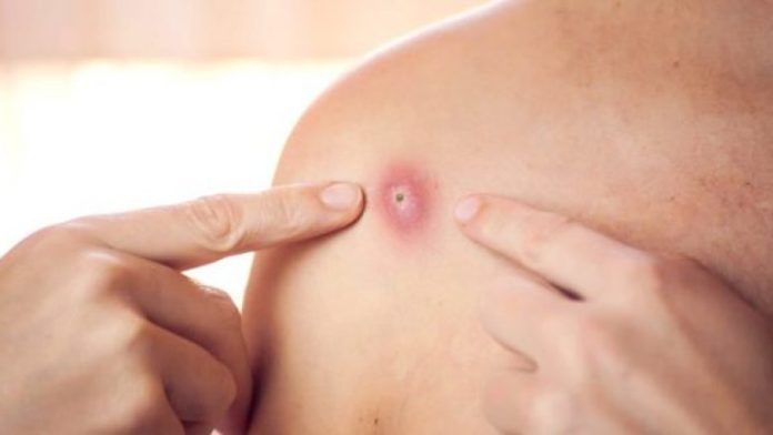 E99481C4-242E-4855-A102-C5BCEA4A6BEA