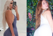 Dëshironte të pasme si të Kim Kardashian, influencuesja rrezikon jetën në operacionin që i kushtoi mijëra euro