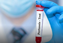 Javën e kaluar janë regjistruar 56 raste të reja me kollën e keqe në Maqedoni