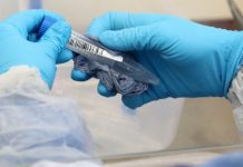 4 vjet burg për kosovarin në Gjermani, përfitoi 4 milionë euro me teste të Covid-19