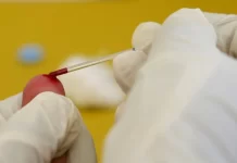 HIV në rritje në Kosovë, 10 raste të reja në pesë muaj