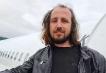 Tragjike: Shqiptari vdes në Turqi pasi mbolli flokët dhe rregulloi dhëmbët