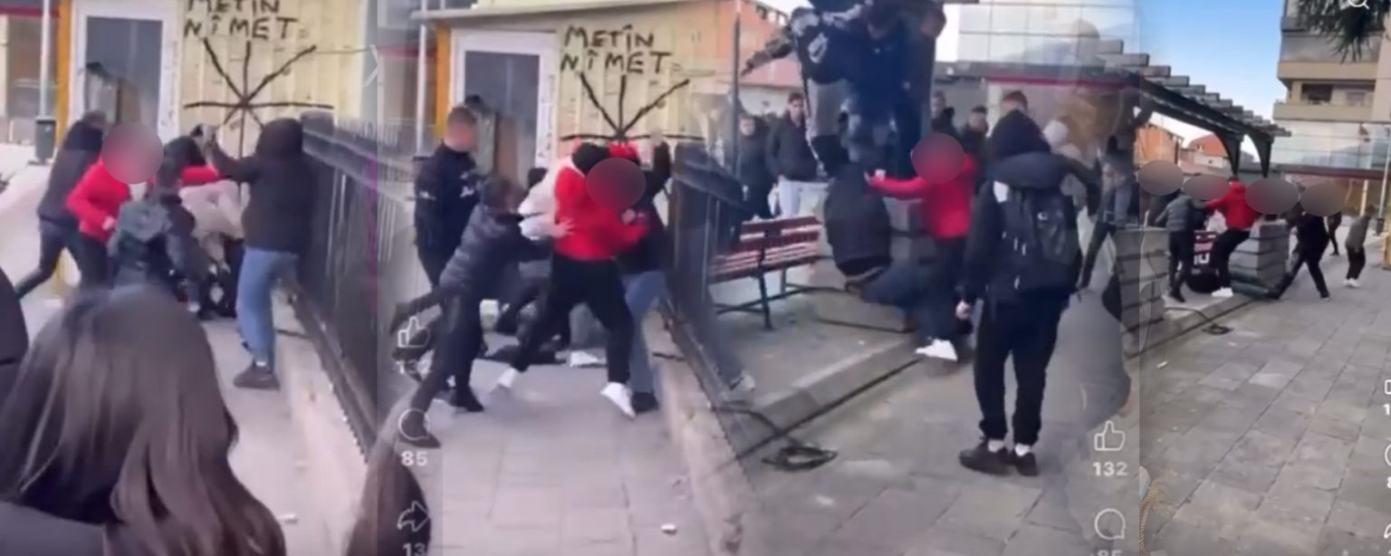 femija-i-dhunuar-ne-saraj-peson-thyerje-te-hundes-dhe-lendime-ne-koke