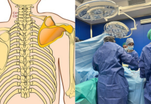 Për herë të parë ndërhyrje kirurgjikale tek fëmijë me deformim kongjenital të rrallë