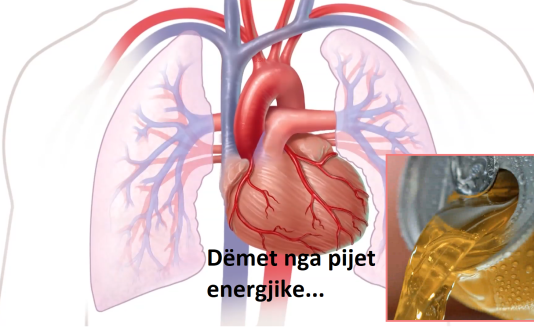 Pijet energjetike “sebep”, dhjetra veta kërkojnë ndihmë në spital