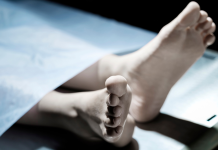 Pasi e goditi kamioni, në vendin e ngjarjes ndërroi jetë 75 vjeçari nga Maqedonia e Veriut