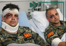 Dy pjesëtarë të ARM-së sulmohen fizikisht nga eprori, përfundojnë në spital