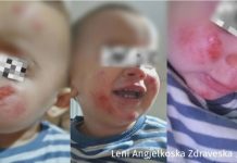 “Ma morën fëmijën nga krahët…”: Nëna dëshmon për tmerrin me dy qenë në rrethinën e Kërçovës