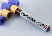 A është e përgatitur Evropa për kërcënimet shëndetësore që vijnë nga hantavirusi?