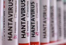 A ekziston një vaksinë për hantavirusin?