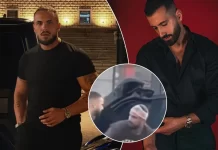 U përfol se janë rrahur me Jozin, Edi shfaqet me fashë në kokë në Tiranë një ditë pas aludimeve