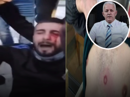 2.500 euro për policët, plumba gome për qytetarët – shteti nuk është pronë private e Edi Ramës!