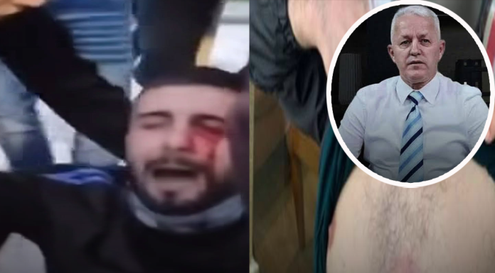 2.500 euro për policët, plumba gome për qytetarët – shteti nuk është pronë private e Edi Ramës!