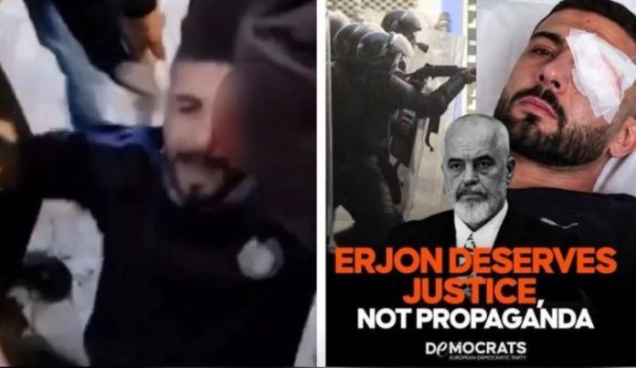 erjon