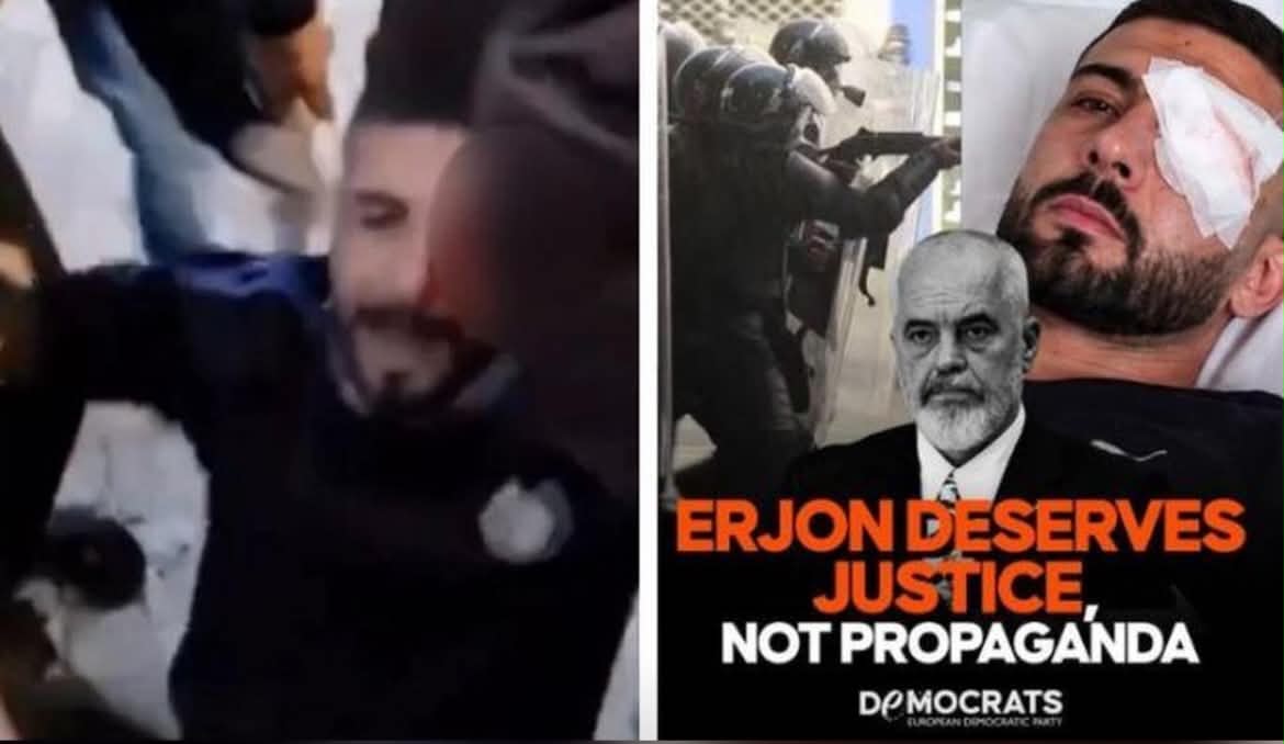 Demokratët Europianë kritikojnë Ramën për plumbat e gomës  Erjon Vishkulli ka nevojë për drejtësi  jo për propagandë 