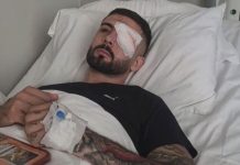 Lajm i mirë nga Roma – Erjon Vishkulli kalon me sukses operacionin, ndërhyrja i shpëton syrin