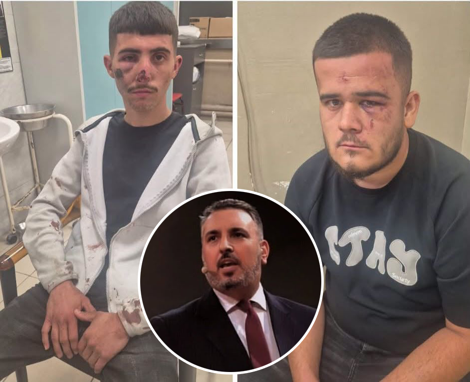 Fazliu godet Qeverinë për dhunën e dyshuar policore   Shqiptarët nuk mund të rrihen e poshtërohen pa pasoja  