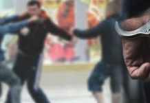 Tmerr në Shkup: Rreth 15 të mitur rrahin brutalisht 13-vjeçarin me sende metalike, ia thyejnë dhëmbët!