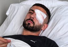 U qëllua me plumb gome në sy, Vishkulli: Isha 30 metra larg efektivëve, nuk po bëja asgjë